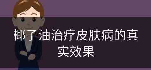 椰子油治疗皮肤病的真实效果